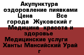 Акупунктура, оздоровление пиявками › Цена ­ 3 000 - Все города, Жуковский г. Медицина, красота и здоровье » Медицинские услуги   . Ханты-Мансийский,Урай г.